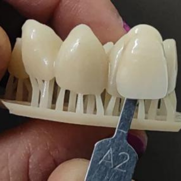 resina 3d libre de monomero para definitivos prizma bio crown 3dresyns varseosmile krear