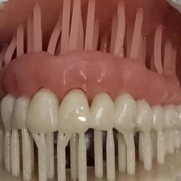 3dresyns libre de monómero puente impreso 3d bio crown prizma varseosmile